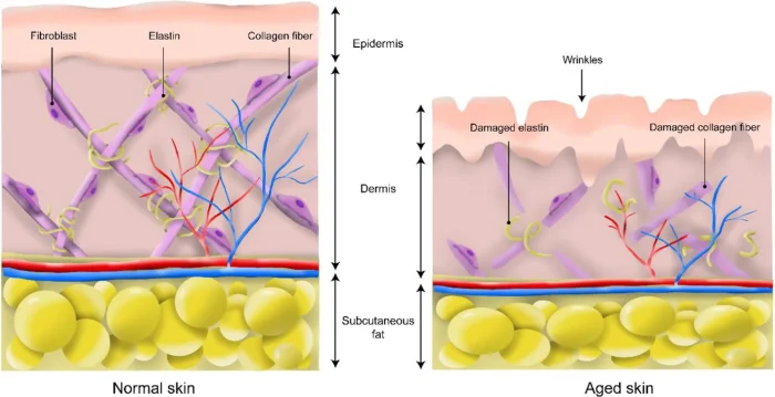 fibroblast